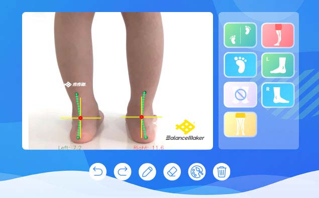 What is the function and principle of correcting insoles?